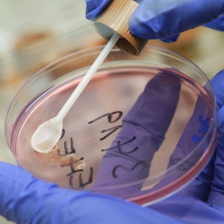 Scientist examining bacteria