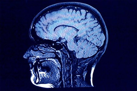 This Is Your Brain on Creatine