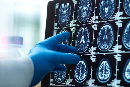 A Rise in Dementia Patients Could Make ER Boarding Even More of a Problem