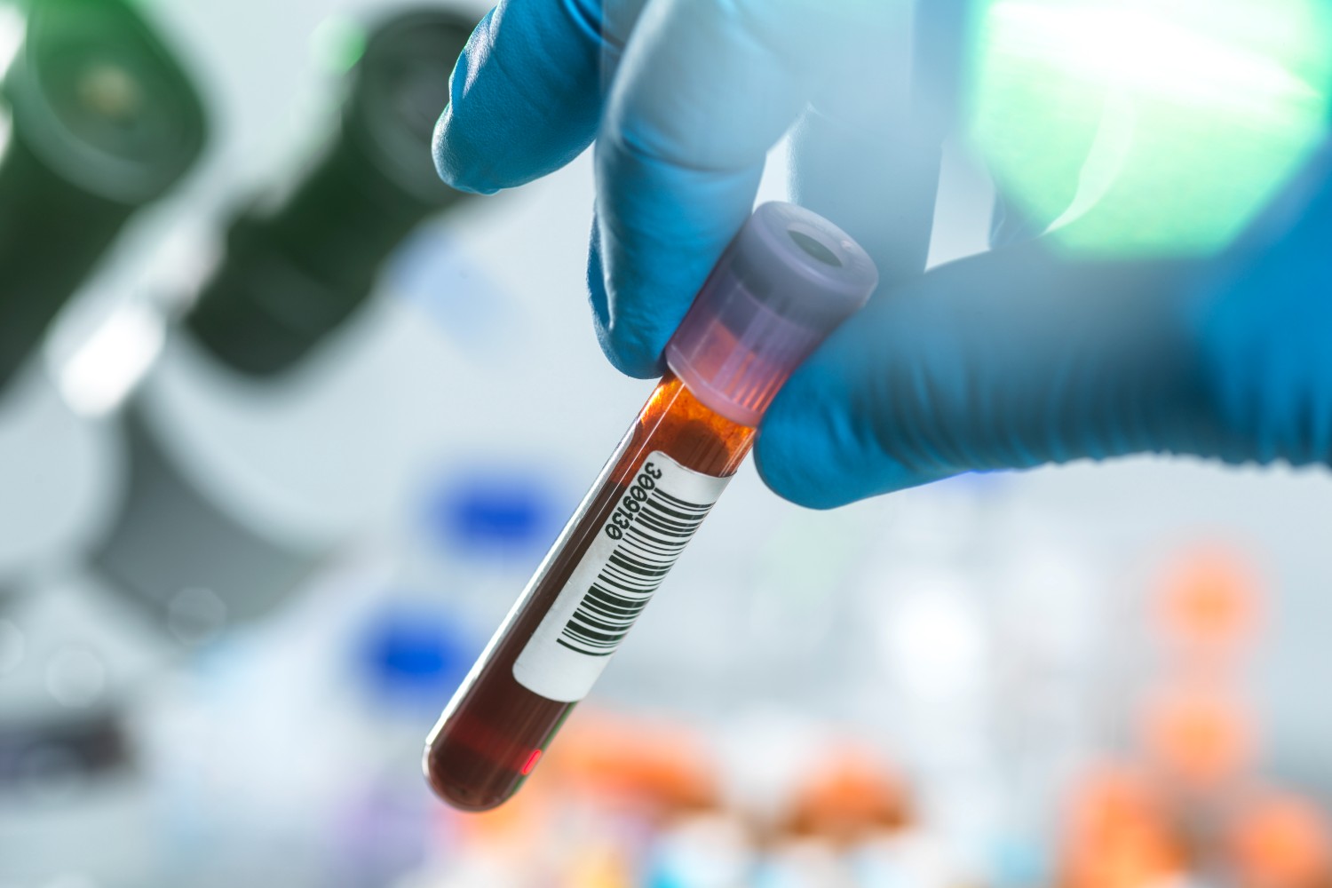 Blood test
