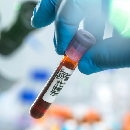 Blood test