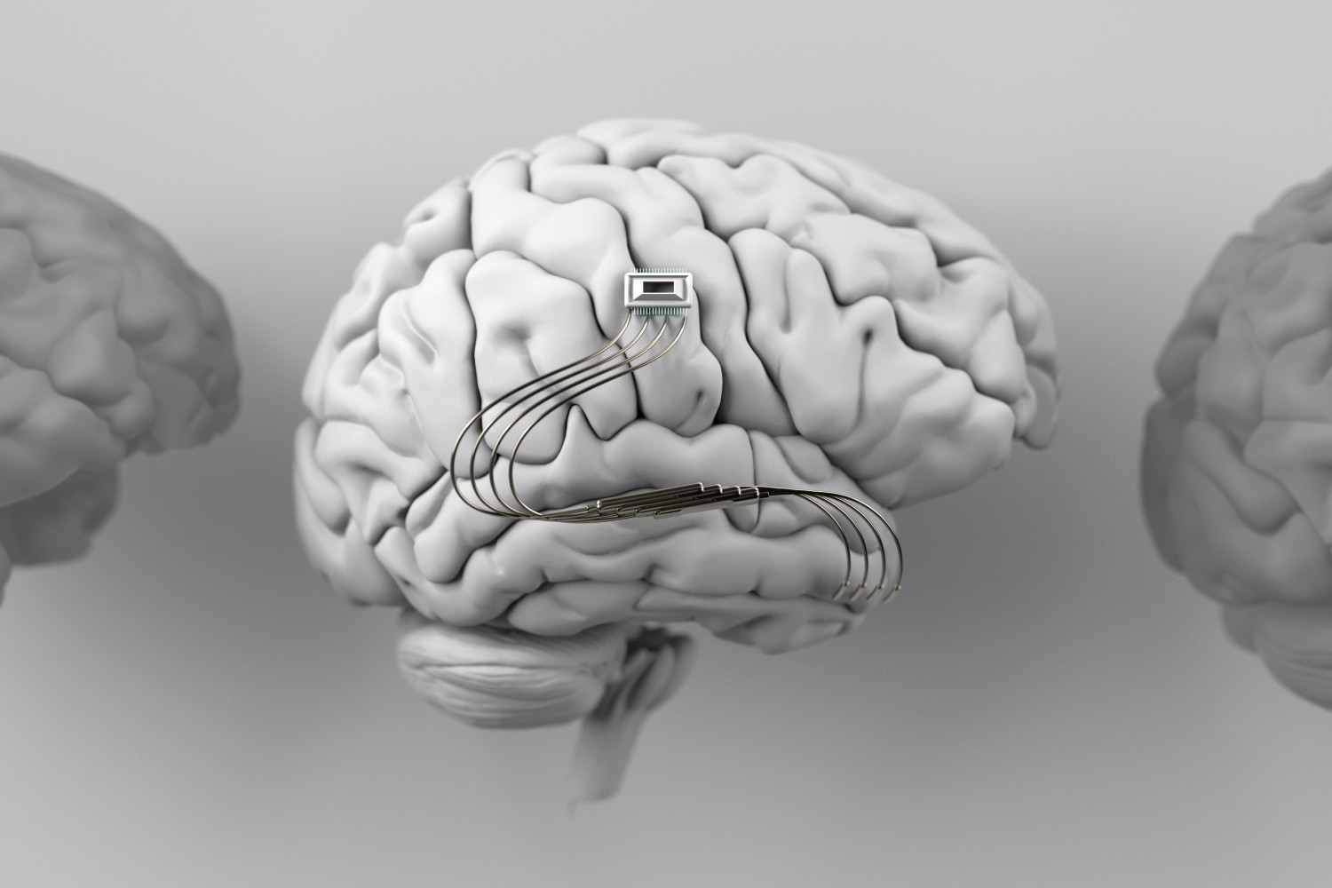 Illustration of a human brain with a computer chip