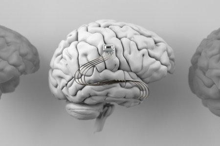 Illustration of a human brain with a computer chip