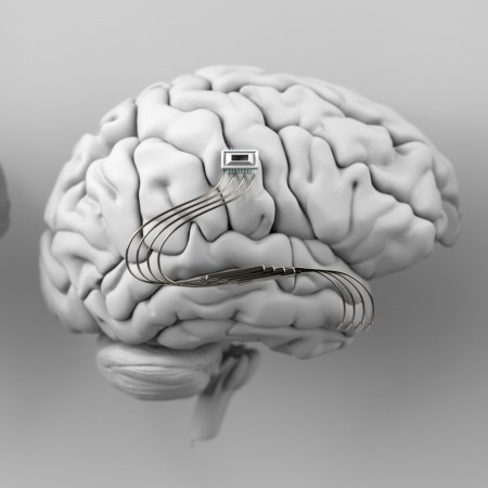 Illustration of a human brain with a computer chip