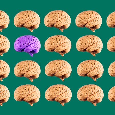 A grid of 20 brains, with 19 brown and 1 purple, on a green background