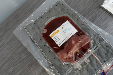 A Groundbreaking Cancer Therapy Is Now Being Used for Autoimmune Conditions