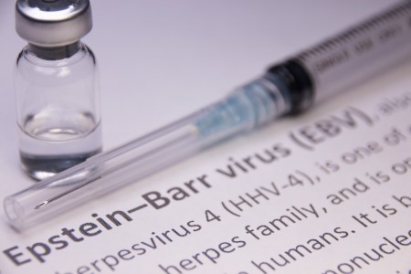 Scientists Found a Formal Connection Between Epstein-Barr Virus and Lupus