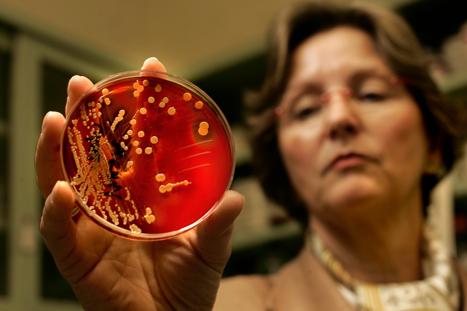 Physician Francoise Perdreau-Remington holds up a sample of the MRSA bacteria.